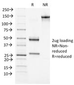 BRCA1 (Breast Marker) Antibody in SDS-PAGE (SDS-PAGE)