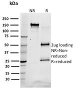 SREBP1 (Transcription Factor) Antibody in SDS-PAGE (SDS-PAGE)