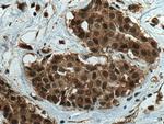 SBDS Antibody in Immunohistochemistry (Paraffin) (IHC (P))