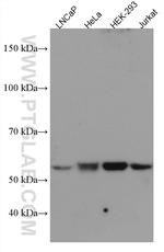 PEPD Antibody in Western Blot (WB)