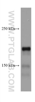 DCC Antibody in Western Blot (WB)