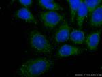 IFIT3 Antibody in Immunocytochemistry (ICC/IF)
