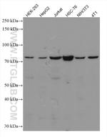 TBK1 Antibody in Western Blot (WB)