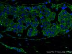 BCAR1 Antibody in Immunohistochemistry (Paraffin) (IHC (P))