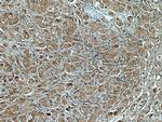 BCAR1 Antibody in Immunohistochemistry (Paraffin) (IHC (P))