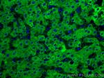 GCK Antibody in Immunohistochemistry (Paraffin) (IHC (P))