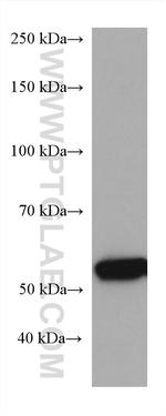 GCK Antibody in Western Blot (WB)