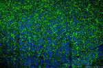 SLC31A1 Antibody in Immunohistochemistry (Paraffin) (IHC (P))