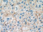 SLC31A1 Antibody in Immunohistochemistry (Paraffin) (IHC (P))