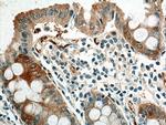 NQO1 Antibody in Immunohistochemistry (Paraffin) (IHC (P))