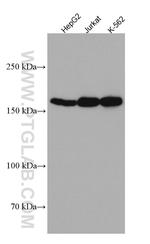 Thrombospondin 1 Antibody in Western Blot (WB)