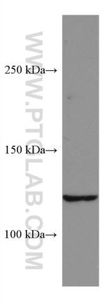 SERCA2/ATP2A2 Antibody in Western Blot (WB)