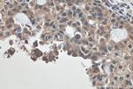 HDAC6 Antibody in Immunohistochemistry (Paraffin) (IHC (P))