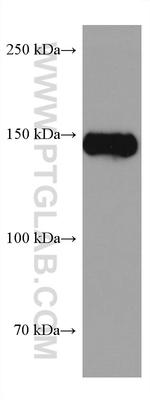 BCR Antibody in Western Blot (WB)