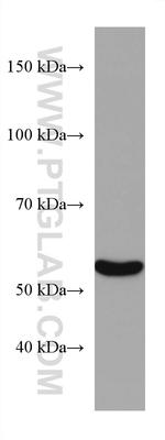 CYP2E1 Antibody in Western Blot (WB)