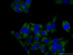 KRAS-2A Antibody in Immunocytochemistry (ICC/IF)