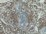 GP9 Antibody in Immunohistochemistry (Paraffin) (IHC (P))