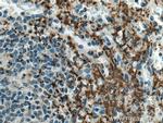 GP9 Antibody in Immunohistochemistry (Paraffin) (IHC (P))