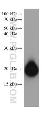 GP9 Antibody in Western Blot (WB)