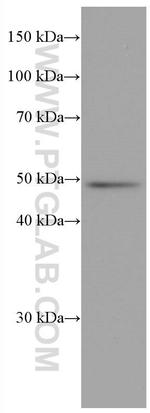 Biglycan Antibody in Western Blot (WB)