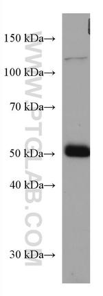 Biglycan Antibody in Western Blot (WB)