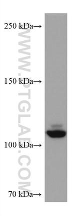 NEDD4L Antibody in Western Blot (WB)