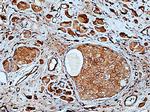 PRLR Antibody in Immunohistochemistry (Paraffin) (IHC (P))