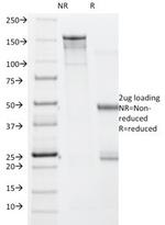 BRAF (V600E Mutant Specific) (Prognostic Marker) Antibody in SDS-PAGE (SDS-PAGE)