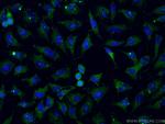 TRAF2 Antibody in Immunocytochemistry (ICC/IF)