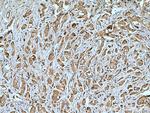 USP8 Antibody in Immunohistochemistry (Paraffin) (IHC (P))