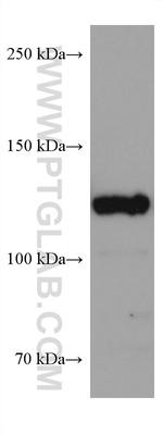 USP8 Antibody in Western Blot (WB)