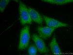 LAMR1/RPSA Antibody in Immunocytochemistry (ICC/IF)