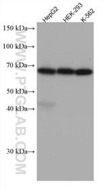 Arp5/ACTR5 Antibody in Western Blot (WB)