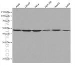 GSK3B Antibody in Western Blot (WB)