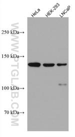 WDR19 Antibody in Western Blot (WB)