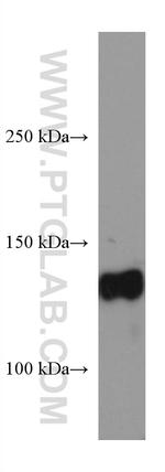 KL Antibody in Western Blot (WB)