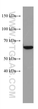 ACSM5 Antibody in Western Blot (WB)