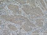 ATG7 Antibody in Immunohistochemistry (Paraffin) (IHC (P))