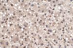 SMAD2 Antibody in Immunohistochemistry (Paraffin) (IHC (P))