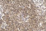 SMAD2 Antibody in Immunohistochemistry (Paraffin) (IHC (P))