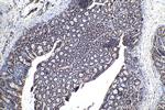 SMAD2 Antibody in Immunohistochemistry (Paraffin) (IHC (P))