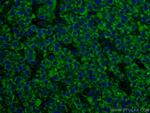 ALDH5A1 Antibody in Immunohistochemistry (Paraffin) (IHC (P))