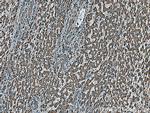 ALDH5A1 Antibody in Immunohistochemistry (Paraffin) (IHC (P))