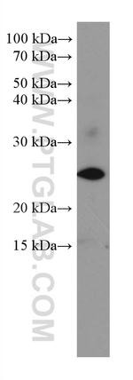 SRY Antibody in Western Blot (WB)