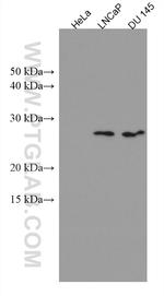 SRY Antibody in Western Blot (WB)