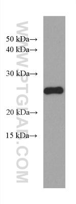 P27/KIP1 Antibody in Western Blot (WB)