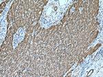 UGDH Antibody in Immunohistochemistry (Paraffin) (IHC (P))