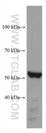 TBXAS1 Antibody in Western Blot (WB)