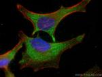 ACC Antibody in Immunocytochemistry (ICC/IF)