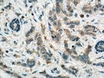 ACC Antibody in Immunohistochemistry (Paraffin) (IHC (P))